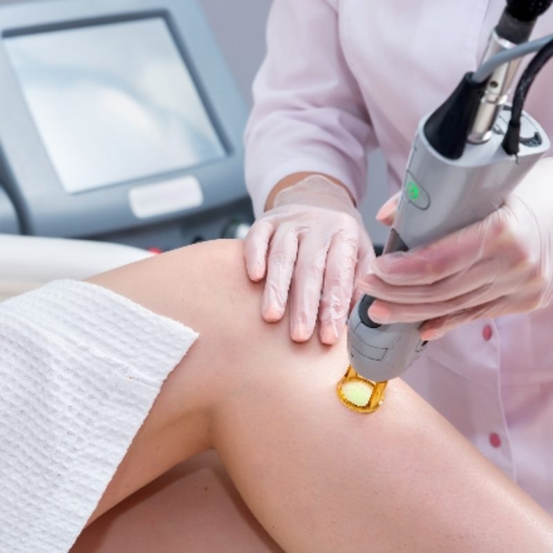 Skin Frax – zabieg na ciało