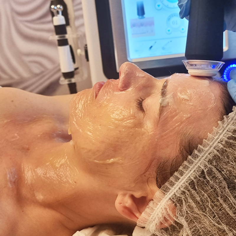 Hydrogen purification AQUAgen+ + OXYgen