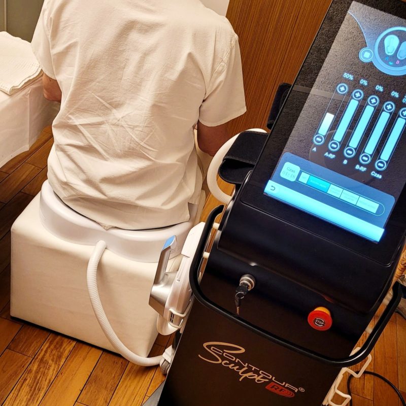 Elektrostymulacja mięśni Kegla